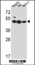 LIPJ Antibody (Center) (Cat. #AP12367c) western blot analysis in HepG2,293,MCF-7 cell line lysates (35ug/lane).This demonstrates the LIPJ antibody detected the LIPJ protein (arrow).