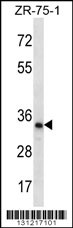 TLCD2 Antibody (C-term) (Cat. #AP12362b) western blot analysis in ZR-75-1 cell line lysates (35ug/lane).This demonstrates the TLCD2 antibody detected the TLCD2 protein (arrow).