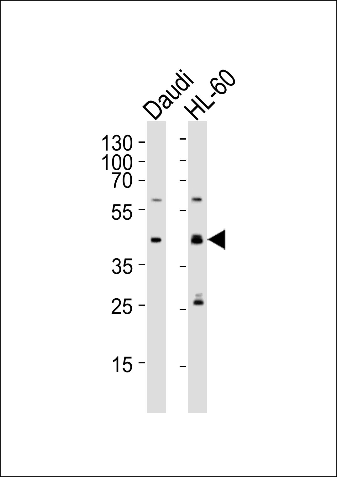Western blot analysis of lysates from Daudi, HL-60 cell line (from left to right), using C109B Antibody (C-term)(Cat. #AP12355b). AP12355b was diluted at 1:1000 at each lane. A goat anti-rabbit IgG H&L(HRP) at 1:5000 dilution was used as the secondary antibody. Lysates at 35ug per lane.