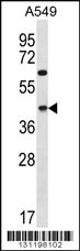 C109B Antibody (C-term) (Cat. #AP12355b) western blot analysis in A549 cell line lysates (35ug/lane).This demonstrates the C109B antibody detected the C109B protein (arrow).