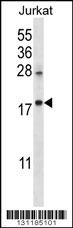 KRTAP25-1 Antibody (C-term) (Cat. #AP12354b) western blot analysis in Jurkat cell line lysates (35ug/lane).This demonstrates the KRTAP25-1 antibody detected the KRTAP25-1 protein (arrow).