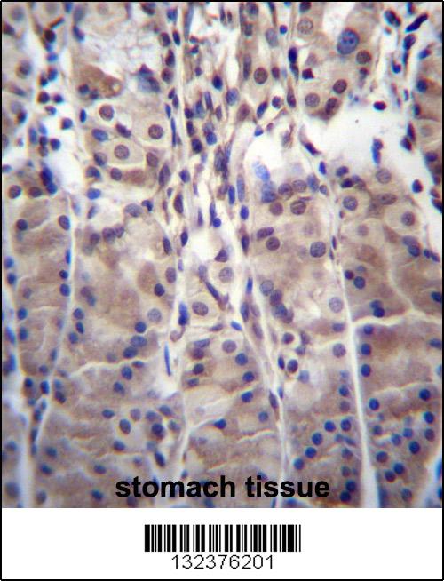 MDM1 Antibody (C-term) (Cat. #AP12344b)immunohistochemistry analysis in formalin fixed and paraffin embedded human stomach tissue followed by peroxidase conjugation of the secondary antibody and DAB staining.This data demonstrates the use of MDM1 Antibody (C-term) for immunohistochemistry. Clinical relevance has not been evaluated.