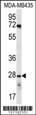 OR10AG1 Antibody (C-term) (Cat. #AP12318b) western blot analysis in MDA-MB435 cell line lysates (35ug/lane).This demonstrates the OR10AG1 antibody detected the OR10AG1 protein (arrow).