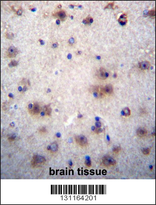 EVPLL Antibody (Center) (Cat. #AP12312c)immunohistochemistry analysis in formalin fixed and paraffin embedded human brain tissue followed by peroxidase conjugation of the secondary antibody and DAB staining.This data demonstrates the use of EVPLL Antibody (Center) for immunohistochemistry. Clinical relevance has not been evaluated.