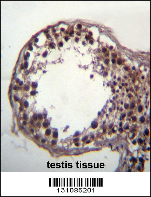 DAZ3 Antibody (C-term) (Cat. #AP12305b)immunohistochemistry analysis in formalin fixed and paraffin embedded human testis tissue followed by peroxidase conjugation of the secondary antibody and DAB staining.This data demonstrates the use of DAZ3 Antibody (C-term) for immunohistochemistry. Clinical relevance has not been evaluated.