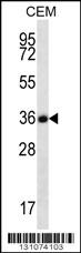 FSTL3 Antibody (C-term) (Cat. #AP12300b) western blot analysis in CEM cell line lysates (35ug/lane).This demonstrates the FSTL3 antibody detected the FSTL3 protein (arrow).