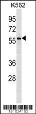 CYP27B1 Antibody (C-term) (Cat. #AP12284b) western blot analysis in K562 cell line lysates (35ug/lane).This demonstrates the CYP27B1 antibody detected the CYP27B1 protein (arrow).