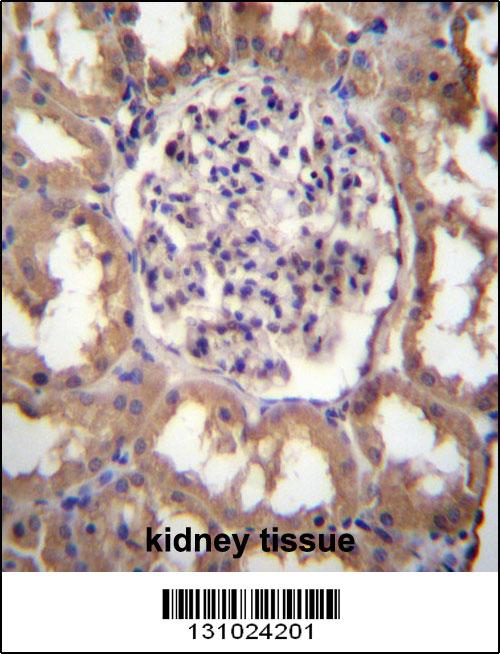 CYP27B1 Antibody (C-term) (Cat. #AP12284b)immunohistochemistry analysis in formalin fixed and paraffin embedded human kidney tissue followed by peroxidase conjugation of the secondary antibody and DAB staining.This data demonstrates the use of CYP27B1 Antibody (C-term) for immunohistochemistry. Clinical relevance has not been evaluated.