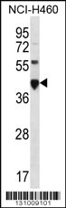 CEACAM18 Antibody (N-term) (Cat. #AP12282a) western blot analysis in NCI-H460 cell line lysates (35ug/lane).This demonstrates the CEACAM18 antibody detected the CEACAM18 protein (arrow).