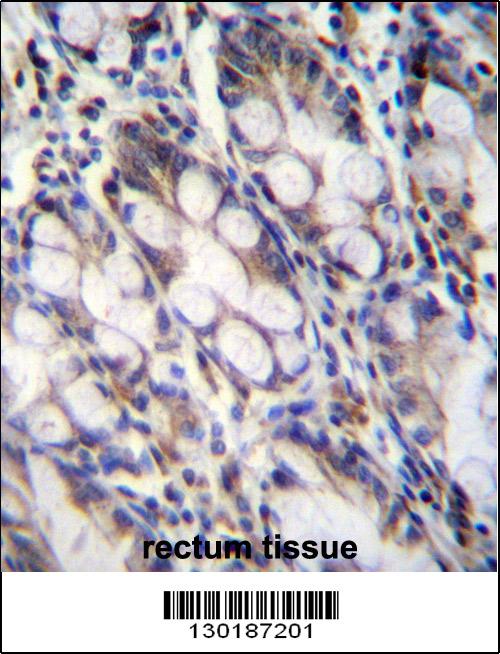 FNDC7 Antibody (C-term) (Cat. #AP12278b)immunohistochemistry analysis in formalin fixed and paraffin embedded human rectum tissue followed by peroxidase conjugation of the secondary antibody and DAB staining.This data demonstrates the use of FNDC7 Antibody (C-term) for immunohistochemistry. Clinical relevance has not been evaluated.