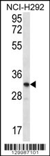 OR51L1 Antibody (N-term) (Cat. #AP12277a) western blot analysis in NCI-H292 cell line lysates (35ug/lane).This demonstrates the OR51L1 antibody detected the OR51L1 protein (arrow).
