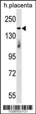 INTS1 Antibody (Cat. #AP12256a) western blot analysis in human placenta tissue lysates (35ug/lane).This demonstrates the INTS1 antibody detected the INTS1 protein (arrow).