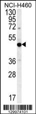 PRAMEF8 Antibody (C-term) (Cat. #AP12211b) western blot analysis in NCI-H460 cell line lysates (35ug/lane).This demonstrates the PRAMEF8 antibody detected the PRAMEF8 protein (arrow).