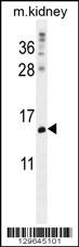 MORN5 Antibody (C-term) (Cat. #AP12205b) western blot analysis in mouse kidney tissue lysates (35ug/lane).This demonstrates the MORN5 antibody detected the MORN5 protein (arrow).
