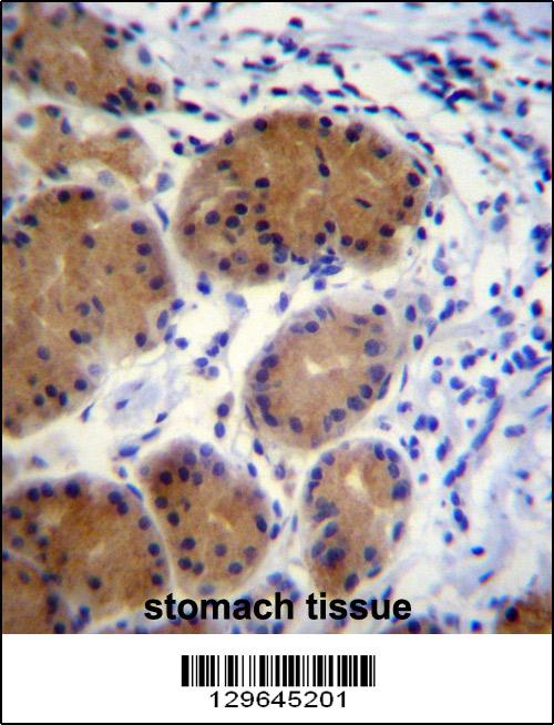 MORN5 Antibody (C-term) (Cat. #AP12205b)immunohistochemistry analysis in formalin fixed and paraffin embedded human stomach tissue followed by peroxidase conjugation of the secondary antibody and DAB staining.This data demonstrates the use of MORN5 Antibody (C-term) for immunohistochemistry. Clinical relevance has not been evaluated.