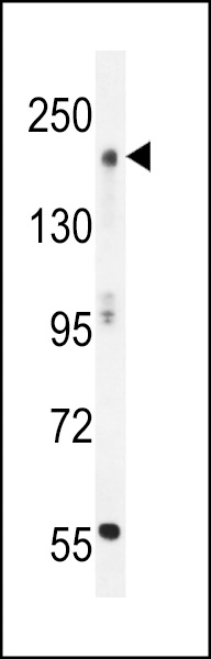 MOZ/MYST3 Antibody (C-term) (Cat. #AP12197b) western blot analysis in mouse stomach tissue lysates (35ug/lane).This demonstrates the MOZ/MYST3 antibody detected the MOZ/MYST3 protein (arrow).