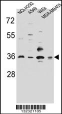 RIC3 Antibody (C-term) (Cat. #AP12721b) western blot analysis in NCI-H292,A549,WiDr,MDA-MB453 cell line lysates (35ug/lane).This demonstrates the RIC3 antibody detected the RIC3 protein (arrow).