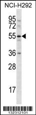 CLEC18A Antibody (C-term) (Cat. #AP12716b) western blot analysis in NCI-H292 cell line lysates (35ug/lane).This demonstrates the CLEC18A antibody detected the CLEC18A protein (arrow).
