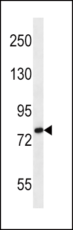 SLC9A2 Antibody (C-term) (Cat. #AP12705b) western blot analysis in MDA-MB231 cell line lysates (35ug/lane).This demonstrates the SLC9A2 antibody detected the SLC9A2 protein (arrow).