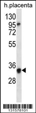 OR6N2 Antibody (C-term) (Cat. #AP12693b) western blot analysis in human placenta tissue lysates (35ug/lane).This demonstrates the OR6N2 antibody detected the OR6N2 protein (arrow).