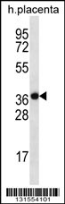 SLC38A8 Antibody (Center) (Cat. #AP12688c) western blot analysis in human placenta tissue lysates (35ug/lane).This demonstrates the SLC38A8 antibody detected the SLC38A8 protein (arrow).