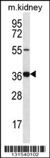 GRXCR1 Antibody (Center) (Cat. #AP12687c) western blot analysis in mouse kidney tissue lysates (35ug/lane).This demonstrates the GRXCR1 antibody detected the GRXCR1 protein (arrow).