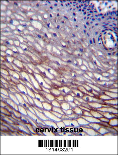 SKA2 Antibody (N-term) (Cat. #AP12680a)immunohistochemistry analysis in formalin fixed and paraffin embedded human cervix tissue followed by peroxidase conjugation of the secondary antibody and DAB staining.This data demonstrates the use of SKA2 Antibody (N-term) for immunohistochemistry. Clinical relevance has not been evaluated.