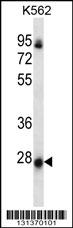 NRSN2 Antibody (C-term) (Cat. #AP12670b) western blot analysis in K562 cell line lysates (35ug/lane).This demonstrates the NRSN2 antibody detected the NRSN2 protein (arrow).