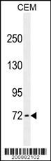 ZFP37 antibody (Cat. #AM1891a) western blot analysis in CEM cell line lysates (35ug/lane).This demonstrates the ZFP37 antibody detected the ZFP37 protein (arrow).