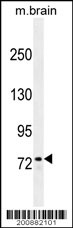 ZFP37 antibody (Cat. #AM1891a) western blot analysis in mouse brain tissue lysates (35ug/lane).This demonstrates the ZFP37 antibody detected the ZFP37 protein (arrow).