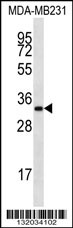 LIX1L Antibody (Center) (Cat. #AP12600c) western blot analysis in MDA-MB231 cell line lysates (35ug/lane).This demonstrates the LIX1L antibody detected the LIX1L protein (arrow).