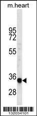 LIX1L Antibody (Center) (Cat. #AP12600c) western blot analysis in mouse heart tissue lysates (35ug/lane).This demonstrates the LIX1L antibody detected the LIX1L protein (arrow).
