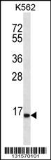 SPINK8 Antibody (C-term) (Cat. #AP12598b) western blot analysis in K562 cell line lysates (35ug/lane).This demonstrates the SPINK8 antibody detected the SPINK8 protein (arrow).