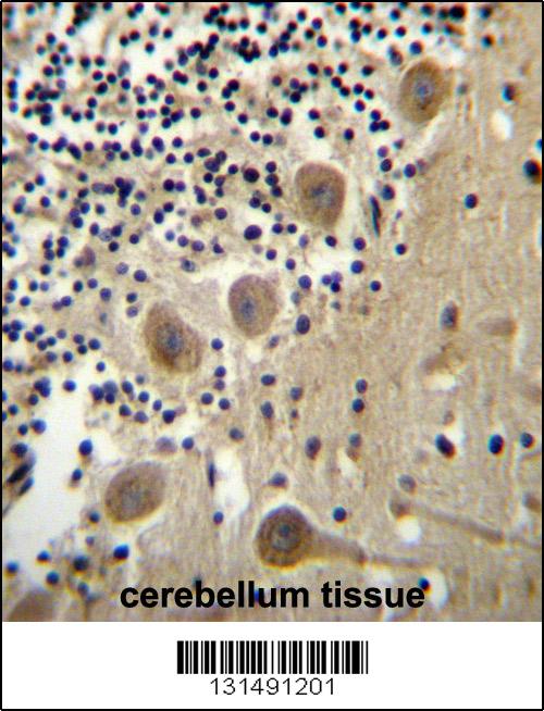 BEND6 Antibody (C-term) (Cat. #AP12587b)immunohistochemistry analysis in formalin fixed and paraffin embedded human cerebellum tissue followed by peroxidase conjugation of the secondary antibody and DAB staining.This data demonstrates the use of BEND6 Antibody (C-term) for immunohistochemistry. Clinical relevance has not been evaluated.