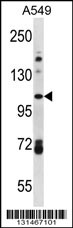 FA13B Antibody (Center) (Cat. #AP12584c) western blot analysis in A549 cell line lysates (35ug/lane).This demonstrates the FA13B antibody detected the FA13B protein (arrow).