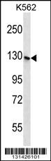 S3TC1 Antibody (C-term) (Cat. #AP12582c) western blot analysis in K562 cell line lysates (35ug/lane).This demonstrates the S3TC1 antibody detected the S3TC1 protein (arrow).