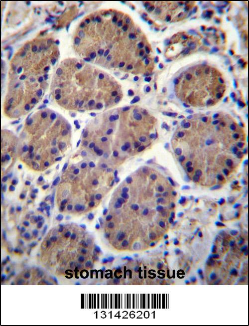 S3TC1 Antibody (C-term) (Cat. #AP12582c)immunohistochemistry analysis in formalin fixed and paraffin embedded human stomach tissue followed by peroxidase conjugation of the secondary antibody and DAB staining.This data demonstrates the use of S3TC1 Antibody (C-term) for immunohistochemistry. Clinical relevance has not been evaluated.