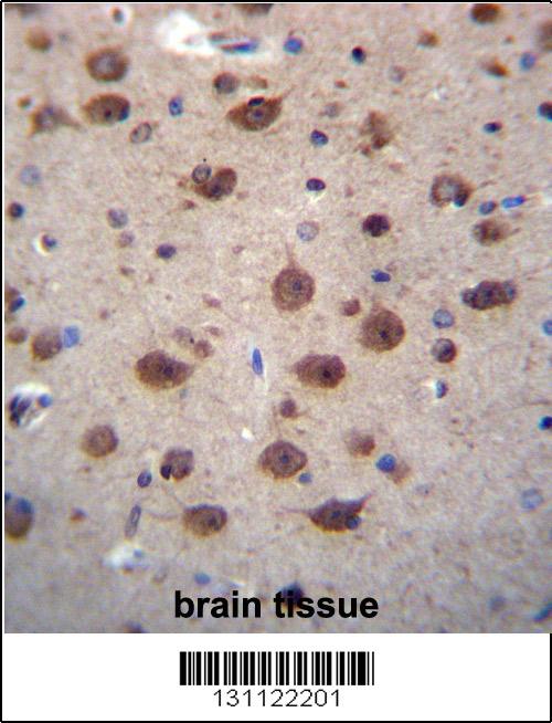 PNKD Antibody (N-term) (Cat. #AP12567a)immunohistochemistry analysis in formalin fixed and paraffin embedded human brain tissue followed by peroxidase conjugation of the secondary antibody and DAB staining.This data demonstrates the use of PNKD Antibody (N-term) for immunohistochemistry. Clinical relevance has not been evaluated.