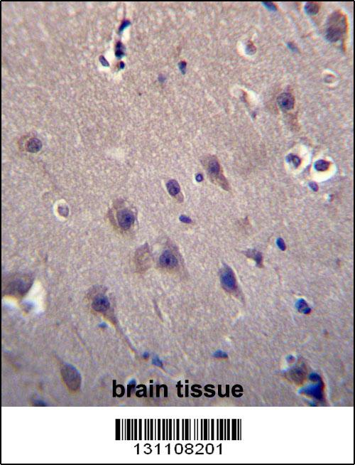 MCF2 Antibody (C-term) (Cat. #AP12563b)immunohistochemistry analysis in formalin fixed and paraffin embedded human brain tissue followed by peroxidase conjugation of the secondary antibody and DAB staining.This data demonstrates the use of MCF2 Antibody (C-term) for immunohistochemistry. Clinical relevance has not been evaluated.
