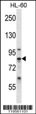 CAPN6 Antibody (Center) (Cat. #AP12546c) western blot analysis in HL-60 cell line lysates (35ug/lane).This demonstrates the CAPN6 antibody detected the CAPN6 protein (arrow).