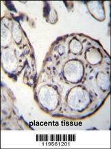 CAPN6 Antibody (Center) (Cat. #AP12546c)immunohistochemistry analysis in formalin fixed and paraffin embedded human placenta tissue followed by peroxidase conjugation of the secondary antibody and DAB staining.This data demonstrates the use of CAPN6 Antibody (Center) for immunohistochemistry. Clinical relevance has not been evaluated.