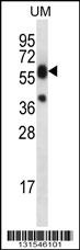 LIPM Antibody (C-term) (Cat. #AP12530b) western blot analysis in uterus tumor cell line lysates (35ug/lane).This demonstrates the LIPM antibody detected the LIPM protein (arrow).