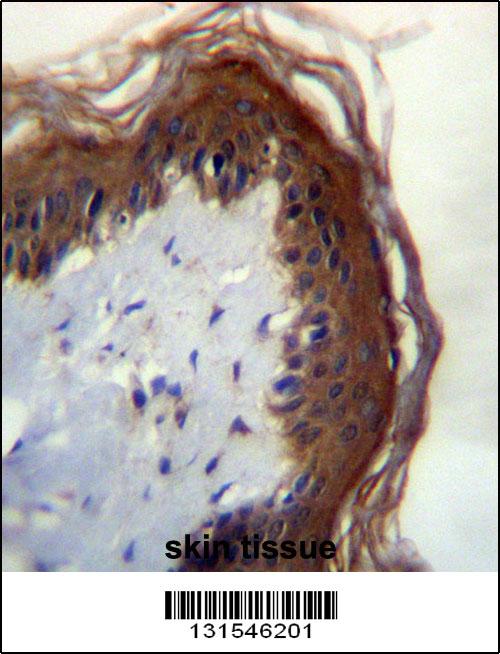LIPM Antibdy (C-term) (Cat. #AP12530b)immunohistochemistry analysis in formalin fixed and paraffin embedded human skin tissue followed by peroxidase conjugation of the secondary antibody and DAB staining.This data demonstrates the use of LIPM Antibdy (C-term) for immunohistochemistry. Clinical relevance has not been evaluated.