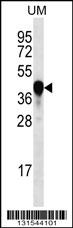PROX2 Antibody (C-term) (Cat. #AP12529b) western blot analysis in uterus tumor cell line lysates (35ug/lane).This demonstrates the PROX2 antibody detected the PROX2 protein (arrow).