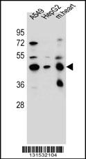 LRRC28 Antibody (C-term) (Cat. #AP12528b) western blot analysis in A549,HepG2 cell line and mouse heart tissue lysates (35ug/lane).This demonstrates the LRRC28 antibody detected the LRRC28 protein (arrow).