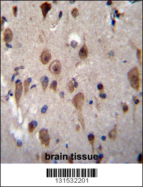 LRRC28 Antibody (C-term) (Cat. #AP12528b)immunohistochemistry analysis in formalin fixed and paraffin embedded human brain tissue followed by peroxidase conjugation of the secondary antibody and DAB staining.This data demonstrates the use of LRRC28 Antibody (C-term) for immunohistochemistry. Clinical relevance has not been evaluated.