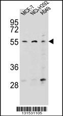 ZNF117 Antibody (N-term) (Cat. #AP12527a) western blot analysis in MCF-7,NCI-H292,A549 cell line lysates (35ug/lane).This demonstrates the ZNF117 antibody detected the ZNF117 protein (arrow).