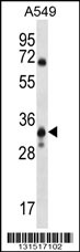MCART6 Antibody (C-term) (Cat. #AP12524b) western blot analysis in A549 cell line lysates (35ug/lane).This demonstrates the MCART6 antibody detected the MCART6 protein (arrow).