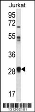 OR11L1 Antibody (C-term) (Cat. #AP12515b) western blot analysis in Jurkat cell line lysates (35ug/lane).This demonstrates the OR11L1 antibody detected the OR11L1 protein (arrow).