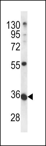 METTL11B Antibody (N-term) (Cat. #AP12508a) western blot analysis in mouse bladder tissue lysates (35ug/lane).This demonstrates the METTL11B antibody detected the METTL11B protein (arrow).